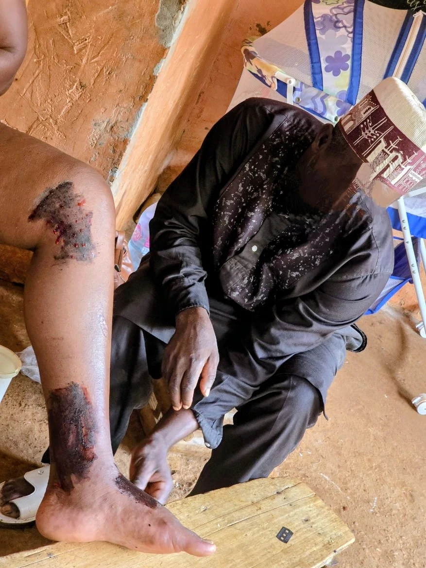 Nganafhu working on a patient, Yaounde (Cameroon), 06/2025, by Maeva PIMO